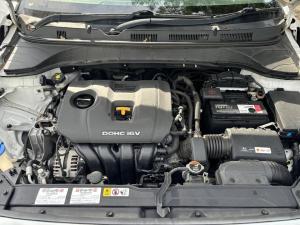 2018 Hyundai Kona image 4